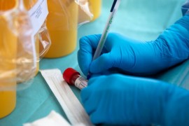 U Hrvatskoj preminulo 49 osoba, zaraženo više od 3.000
