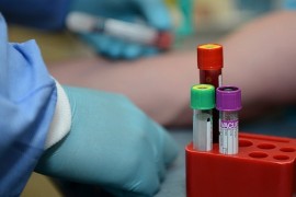 U Srbiji umrlo još 37 osoba, zaražene 6.842