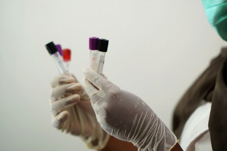 U Brčkom još 93 slučaja virusa korona, preminule tri osobe