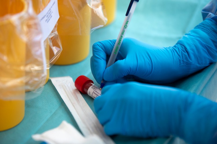 Virus korona potvrđen kod 387 оsоba u RS, 26 smrtnih slučajeva