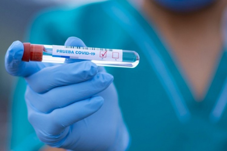 U Crnoj Gori preminulo devet osoba, još 639 zaraženo