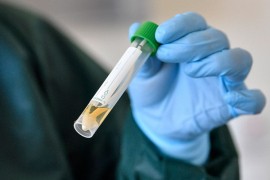 Preminula četiri muškarca u Brčkom, još 65 zaraženih