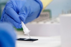 Masovno dobrovoljno testiranje od sutra širom Slovenije