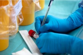 U Hrvatskoj јoš 1.595 zaraženih, preminula 71 osoba