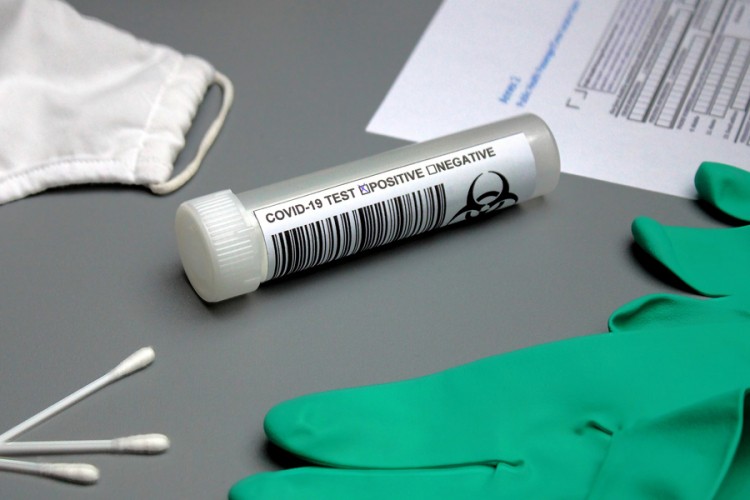 U FBiH pojeftinio PCR test, Srpska razmatra niže cijene