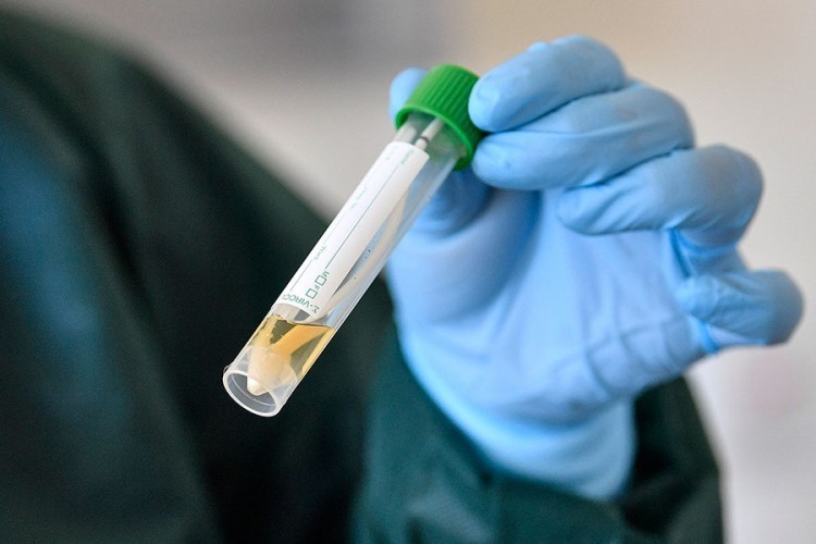 U Hrvatskoj preminulo 78 osoba, 3.363 novozaraženih