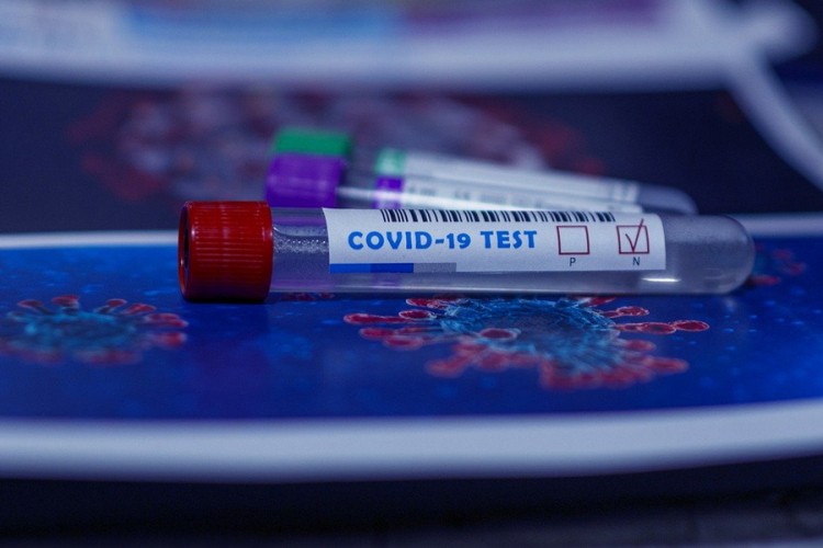 Predloženo uvođenje obaveznog negativnog PCR testa pri ulasku u BiH
