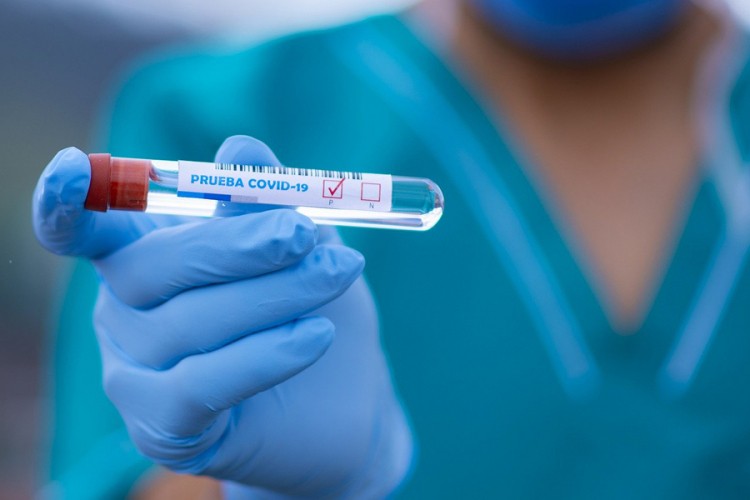 U Crnoj Gori preminule tri osobe, 377 novozaraženih