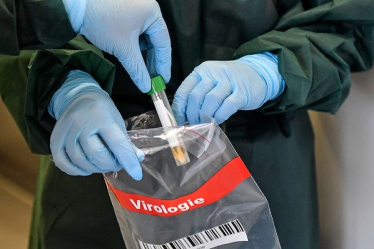 U FBiH umrlo 29 osoba, 157 zaraženo