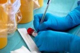 Opada broj zaraženih, u Novom Sadu 27 novih slučajeva
