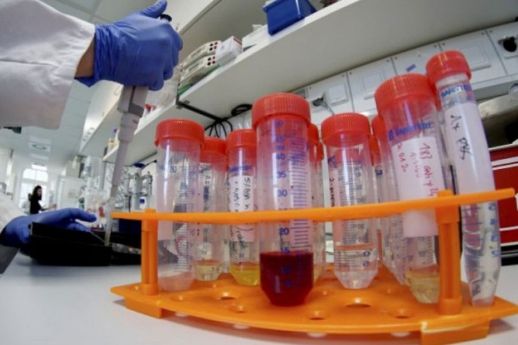 U Srbiji 2.142 zaraženih, preminulo 29 osoba