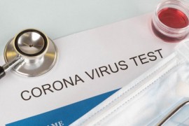 Banjalučanin osumnjičen za falsifikovanje PCR testova