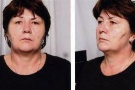 Mediji: Kraljici džeparoša zatvor i obavezno psihijatrijsko liječenje