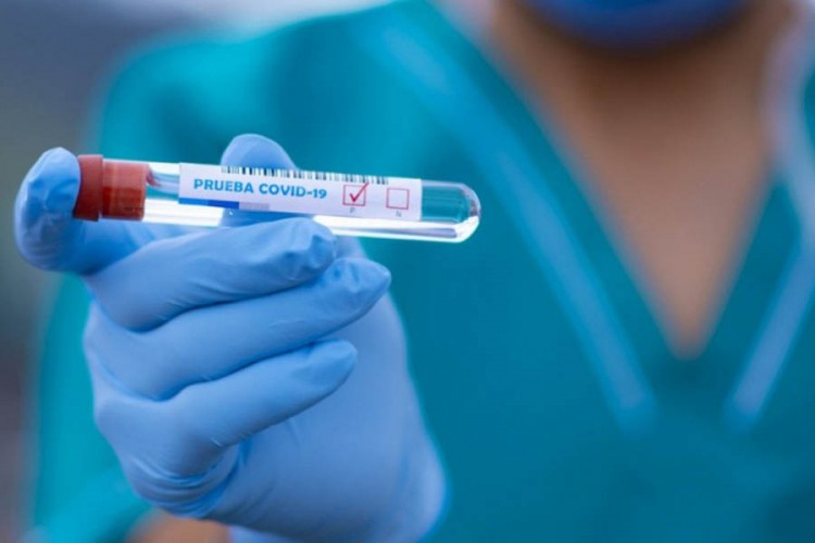 U Hrvatskoj još 549 zaraženih, 16 preminulih