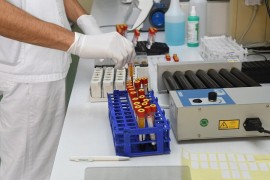 Odjeljenje za urologiju s pedijatrijom u Trebinju ponovo u kovid režimu