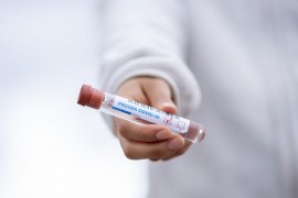 Britanska agencija odobrila test za koronu koji se obavi za 20 sekundi