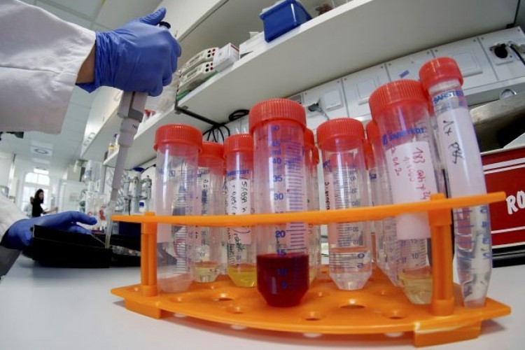 U Srpskoj još 578 zaraženih, 17 smrtnih slučajeva