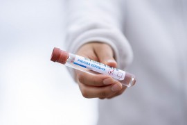 U Sloveniji preminulo sedam osoba, zaraženo još 287