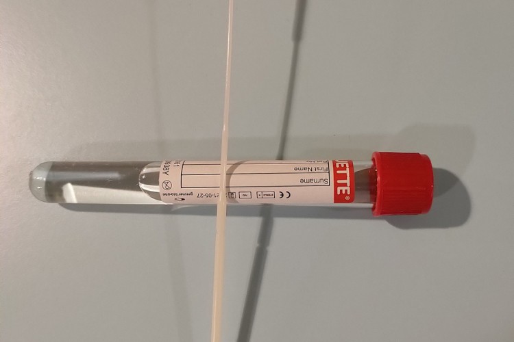Na Rači otkriveni falsifikovani PCR testovi