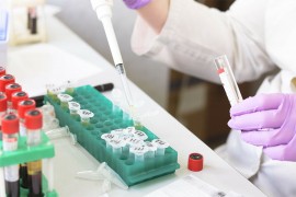 Formirana kinesko-srpska laboratorija za otkriće novih lijekova