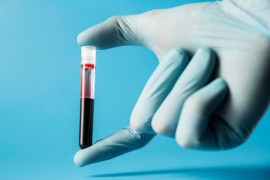U ambulanti u Platonovoj ulici počinje s radom laboratorija
