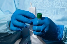 U FBiH pet preminulih, zaraženo još 400