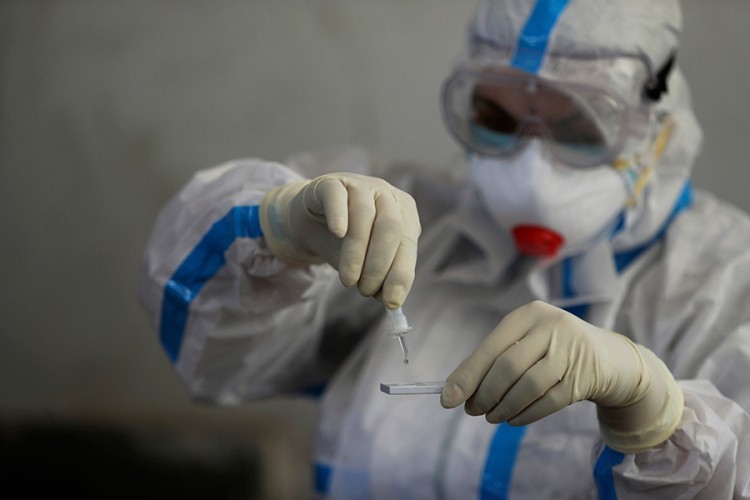 U Sloveniji preminule dvije osobe, 244 zaražene