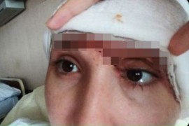 Humanitarni bazar za teško povrijeđenu Milenu 11. septembra