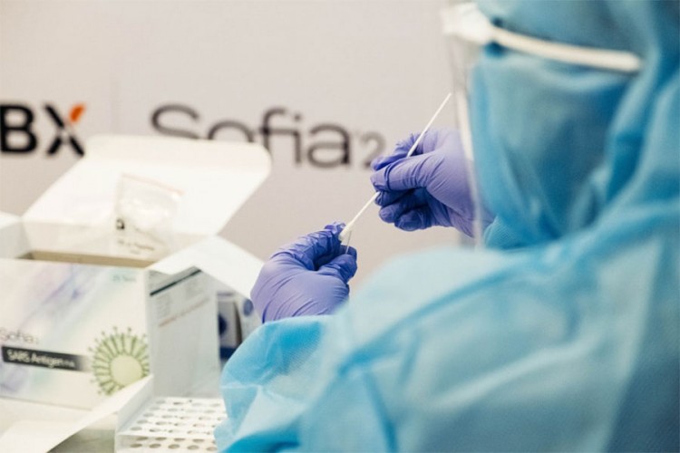 Crna Gora broji 419 novozaraženih