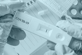 Prvi srpski test za kovid 19 u upotrebi tek od sljedeće godine?