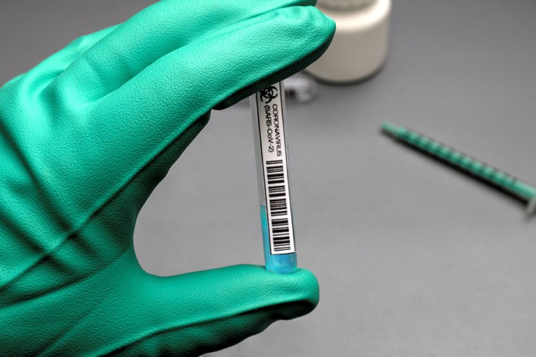 Njemačka ukida besplatno testiranje, evo na koga se odnosi