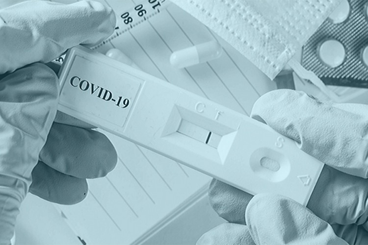 Prvi srpski test za kovid 19 u upotrebi tek od sljedeće godine?