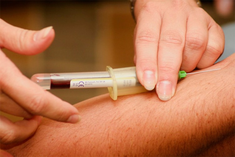 I oni koji su preležali virus mogu biti davaoci krvi