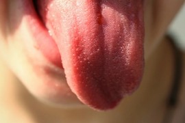 Male bijele tačkice na jeziku upozoravaju na veoma opasnu bolest
