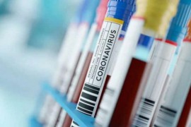 U Sloveniji preminulo 18, zaraženo 8.396 osoba