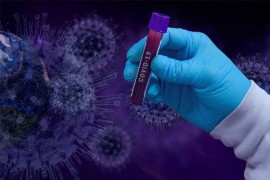 U Srbiji 2.886 slučajeva zaraženo koronom, 39 osoba preminulo