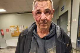 Suad Žilić tvrdi da ga je pretukla policija nakon što je izvršio ...