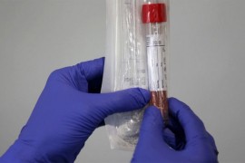 U Srpskoj 23 novozaražene osobe, prijavljena dva smrtna slučaja