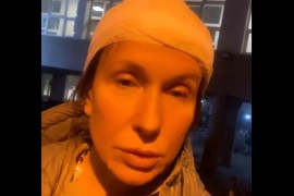Voditeljka Snežana Dakić pogođena kamenom u glavu