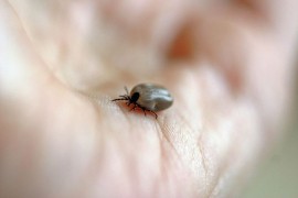 Epidemiolog objašnjava šta raditi u slučaju ujeda krpelja