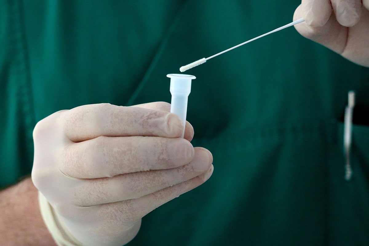 Naučnici registrovali novi test na kovid 19