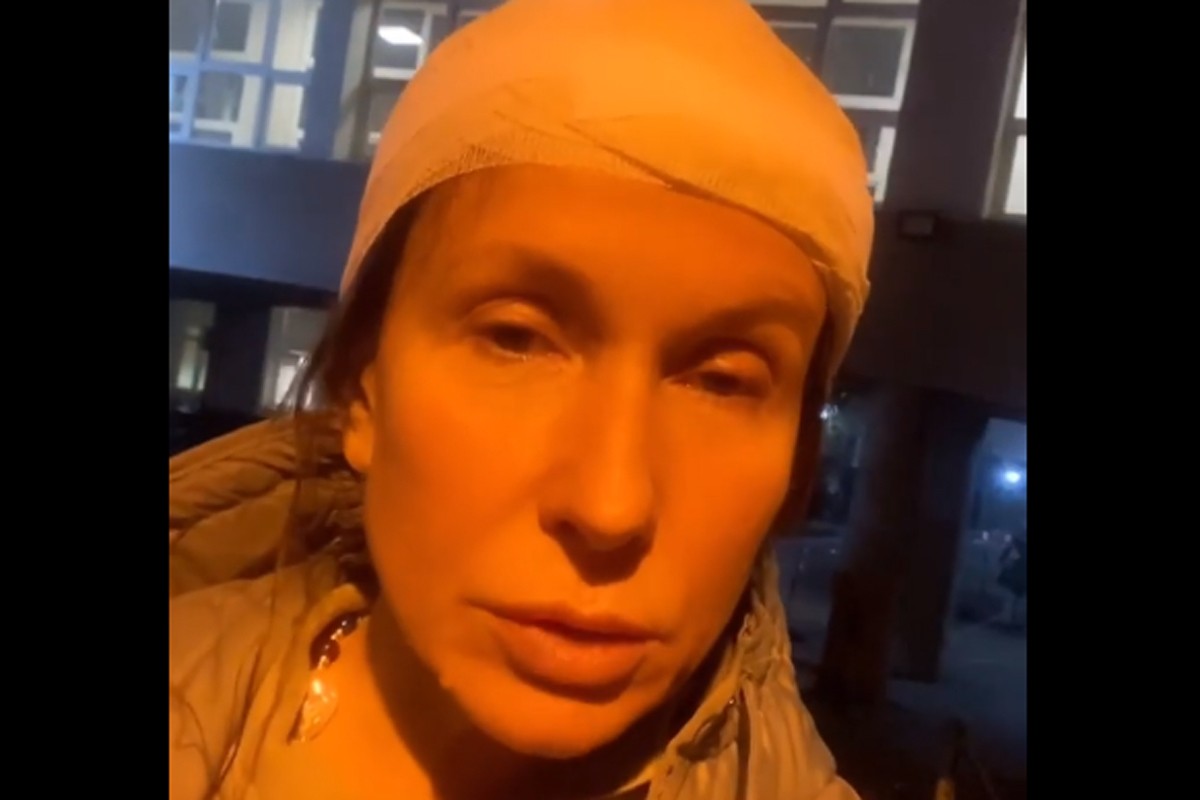Voditeljka Snežana Dakić pogođena kamenom u glavu