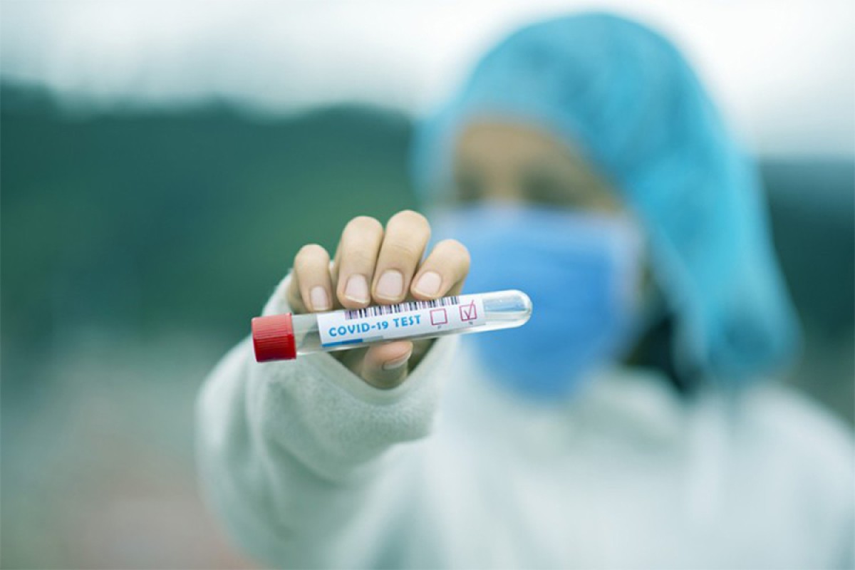 U Srpskoj pet novozaraženih, nema preminulih