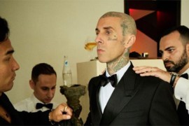 Travis Barker završio u bolnici