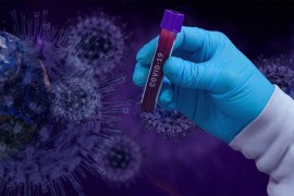 Virus korona potvrđen kod 30 osoba u Srpskoj