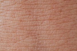 4 simptoma na koži znak da nemate dovoljno soli u organizmu