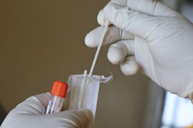 Novi smrtni slučaj od majmunskih boginja u Španiji