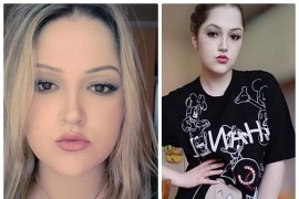 Mladoj medicinskoj sestri bez posla potrebna pomoć za liječenje