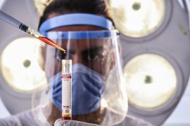 Prvi na svijetu istovremeno pozitivan na majmunske boginje, koronu i HIV