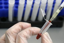 U Srbiji potvrđen 81 slučaj zaraze groznicom Zapadnog Nila